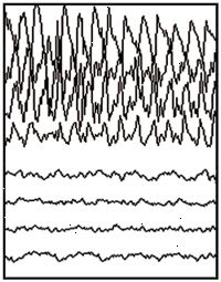 Ejecución parcial EEG Ejecución parcial EEG