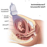 Ilustración del ultrasonido fetal del transabdominal