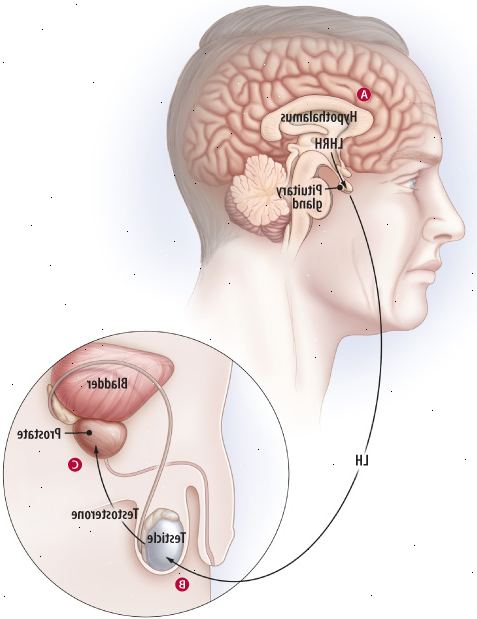 ¿Cómo la terapia hormonal afecta la cascada de andrógenos ¿Cómo la terapia hormonal afecta la cascada de andrógenos
