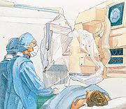 Monitores permiten al médico seguir el avance del catéter durante el procedimiento. Monitores permiten al médico seguir el avance del catéter durante el procedimiento.