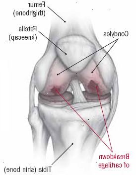 Rodilla