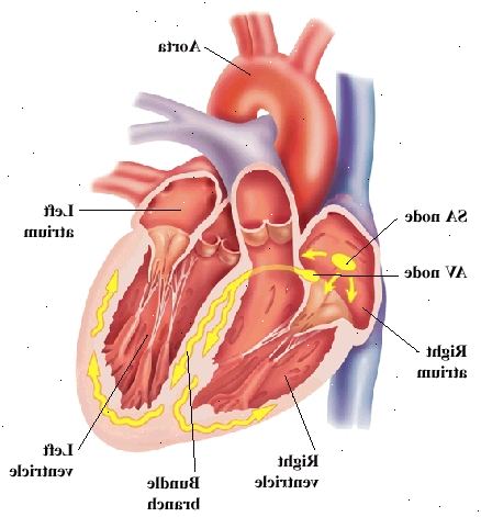 Vista frontal del corazón que muestra en la parte superior aurículas y los ventrículos en la parte inferior. Aorta es gran arteria que sale del corazón en la parte superior. Nodo SA y el nodo AV están en la aurícula derecha. Nervios de rama se encuentran en la pared entre los ventrículos y la curva de las paredes ventriculares. Las señales de AV nodo viajes al nodo AV y en ramas del haz. Vista frontal del corazón que muestra en la parte superior aurículas y los ventrículos en la parte inferior. Aorta es gran arteria que sale del corazón en la parte superior. Nodo SA y el nodo AV están en la aurícula derecha. Nervios de rama se encuentran en la pared entre los ventrículos y la curva de las paredes ventriculares. Las señales de AV nodo viajes al nodo AV y en ramas del haz.