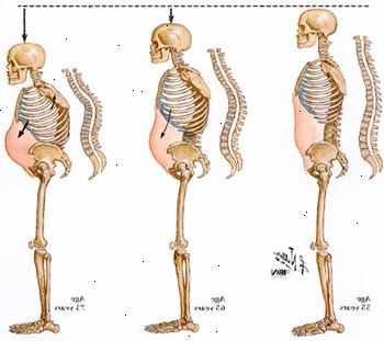 ¿Cómo comprime la columna vertebral con la edad ¿Cómo comprime la columna vertebral con la edad