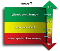 Ilustración de t-score y lo que significa Ilustración de t-score y lo que significa