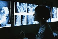 Fotografía de un médico visualización enema de bario de películas de rayos X Fotografía de un médico visualización enema de bario de películas de rayos X