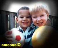 Fotografía simulada de glaucoma Fotografía simulada de glaucoma