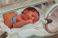 Fotografía de un bebé en la unidad de cuidados intensivos neonatales Fotografía de un bebé en la unidad de cuidados intensivos neonatales