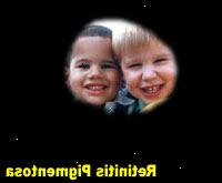 Fotografía simulada de la retinitis pigmentosa