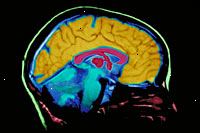 Una imagen de una película de imagen de resonancia magnética del cerebro Una imagen de una película de imagen de resonancia magnética del cerebro