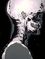 Una imagen de una radiografía de la cabeza Una imagen de una radiografía de la cabeza