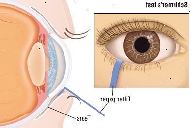Ojos Ojos