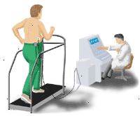 Dibujo que demuestra el electrocardiograma de esfuerzo