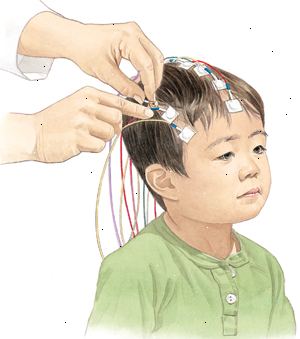Durante un EEG, se colocan electrodos en el cuero cabelludo de su hijo por lo que la actividad eléctrica del cerebro se puede grabar. Durante un EEG, se colocan electrodos en el cuero cabelludo de su hijo por lo que la actividad eléctrica del cerebro se puede grabar.
