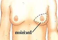 Tetas